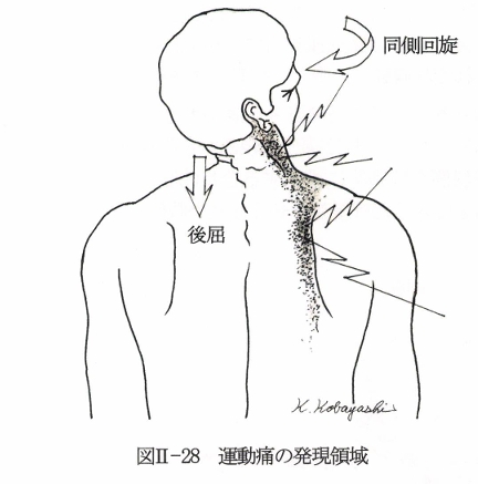 首の運動痛の図
