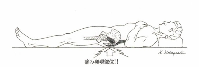 仰向けでの腰痛の図