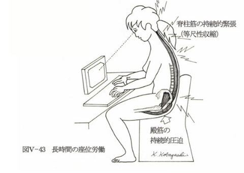 座位姿勢での腰痛の図