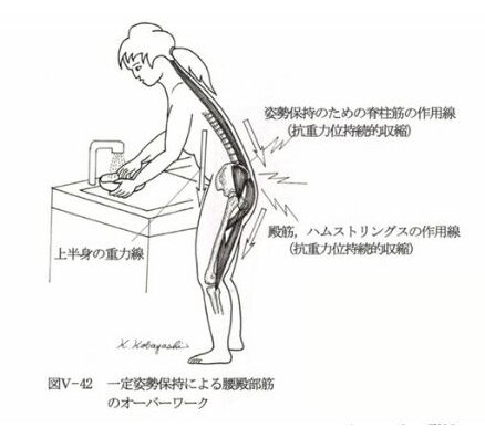 中腰姿勢での腰痛の図