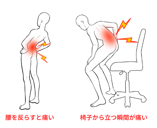 腰の運動痛