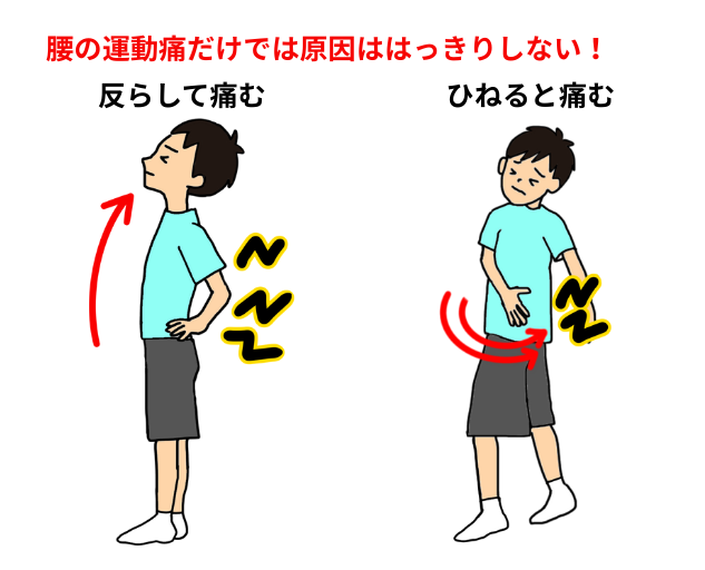 腰椎分離症の症状