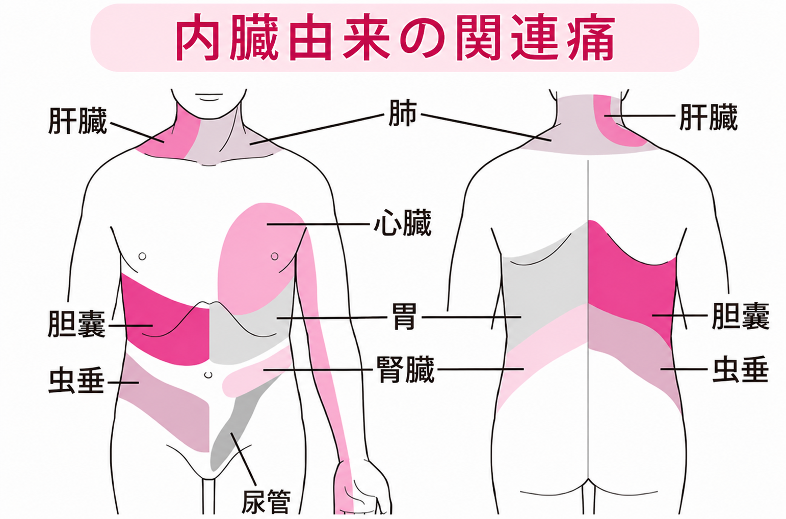内臓由来の関連痛