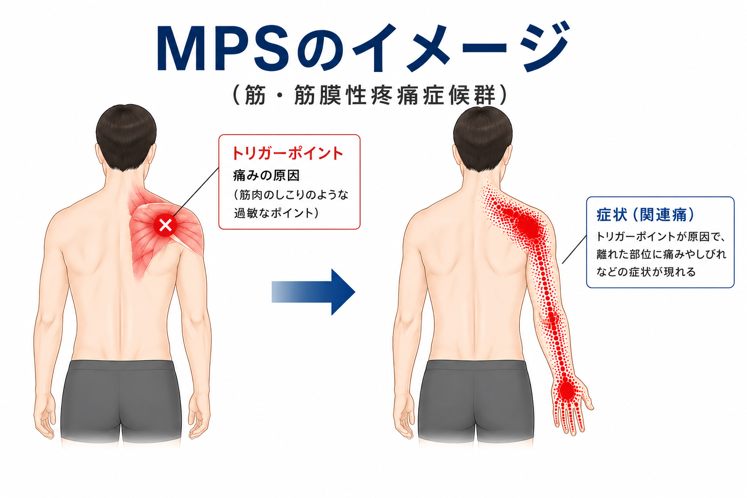 MPSのイメージ図