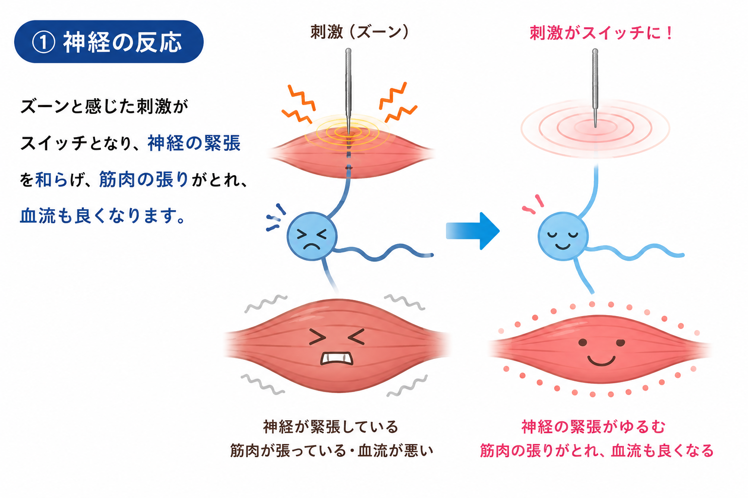 鍼の作用のイメージ図