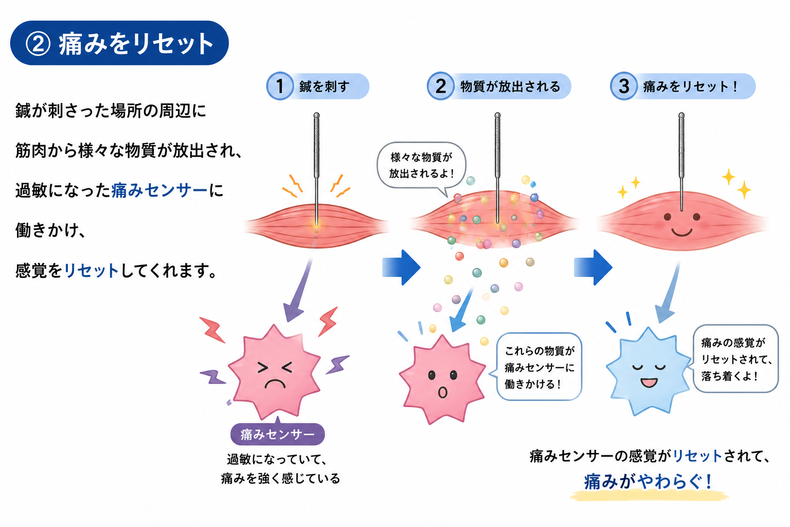 鍼の効果のイメージ図