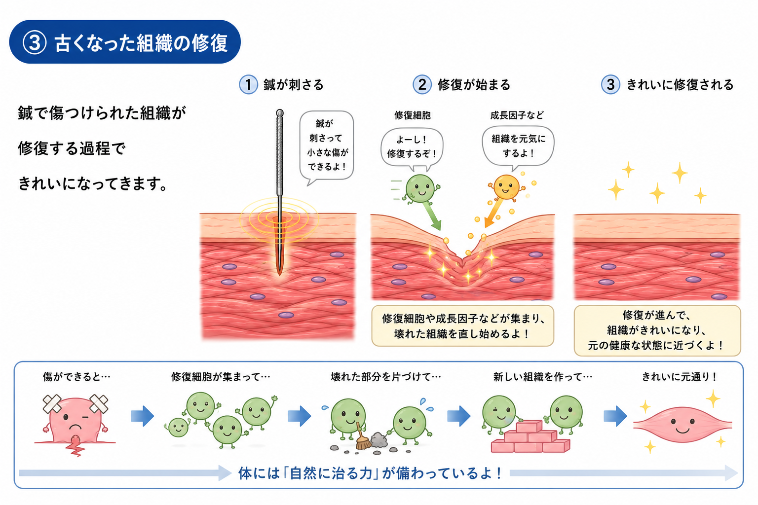 鍼の効果のイメージ図③