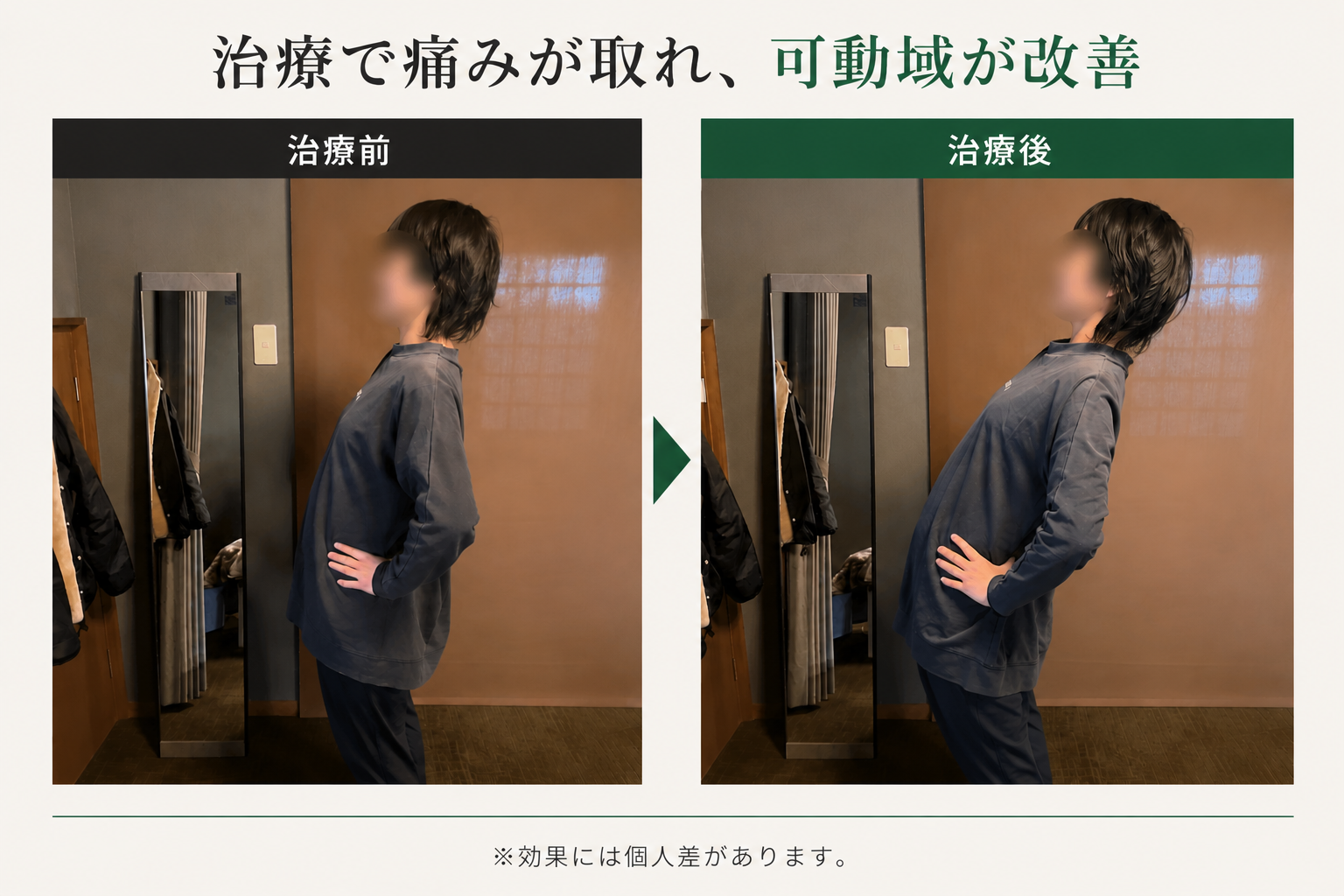 腰痛治療ビフォーアフター写真