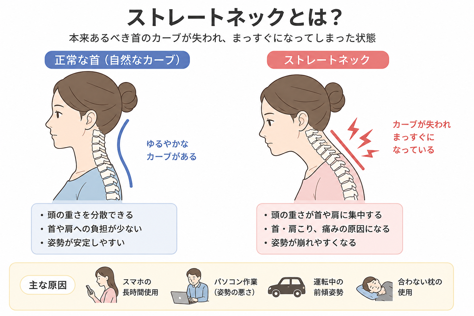 ストレートネックの説明