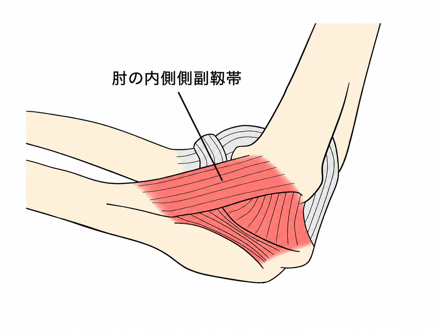 肘の内側側副靭帯の解剖図