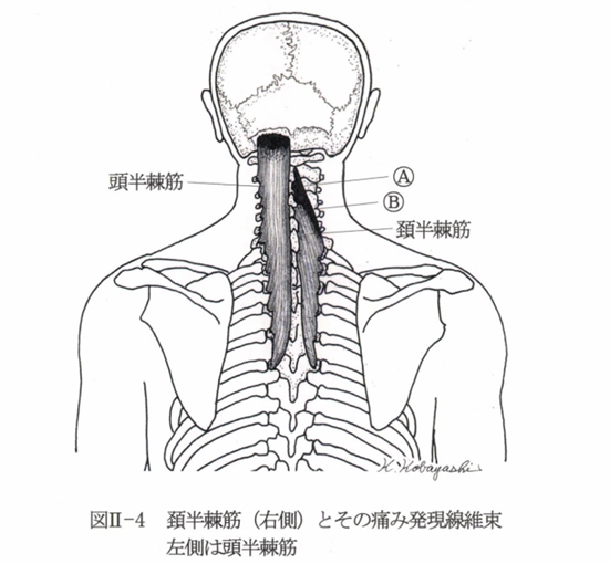 頭・頚半棘筋の解剖図
