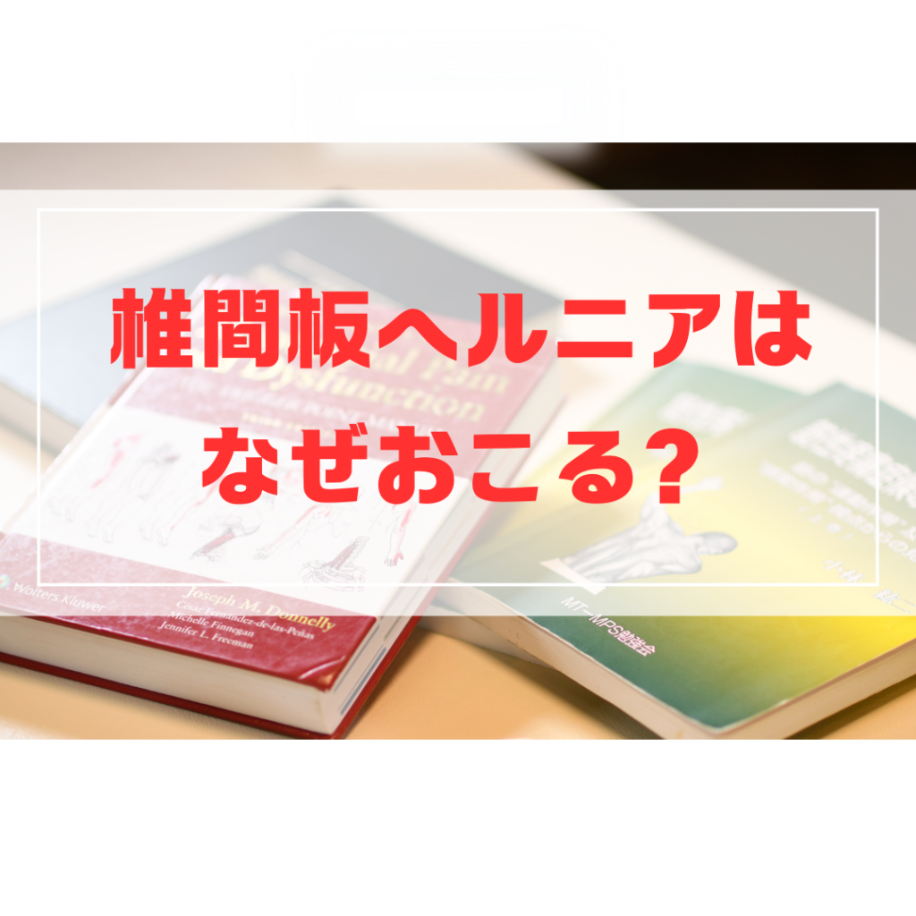 ヘルニアに関する記事のサムネイル